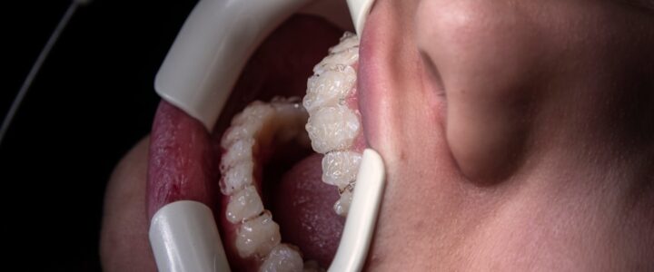 Dental: En Uundgåelig Del af Vores Sundhed BHJGUV5S9T 20260104